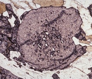 photomicrograph