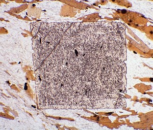 photomicrograph