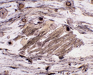 photomicrograph