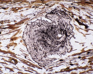 photomicrograph